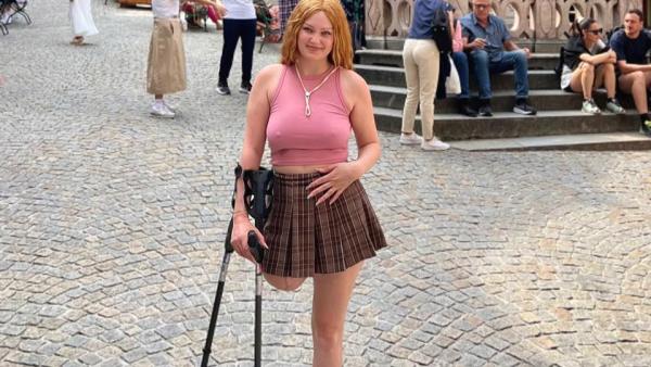 Andreea Anița, tânăra care a mobilizat România în lupta cu o formă rară de cancer, a pierdut lupta cu boala