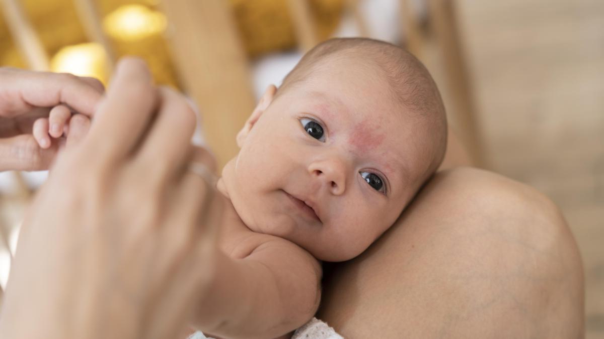 acnee-si-alte-cosuri-la-bebelusi-cum-sa-le-distingem-si-cum-procedam-daca-apar_67275100