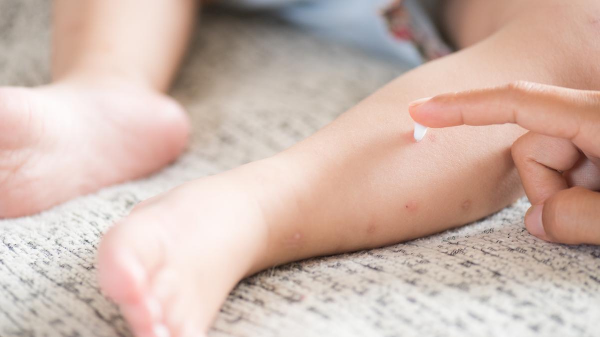 tot-mai-multe-cazuri-de-rujeola-inregistrate-in-tara_37907500