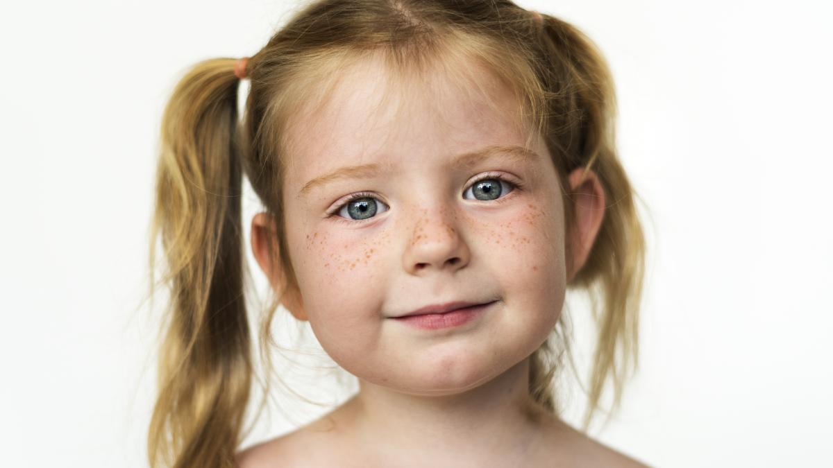 ce-este-impetigo-si-cum-se-transmite_30502300