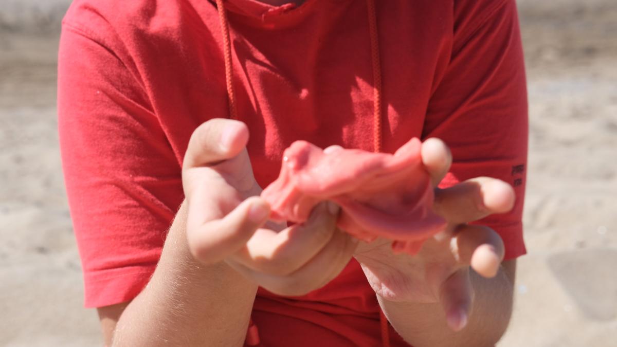 pulpita-de-la-piscina-o-leziune-cutanata-foarte-frecventa-la-copii-vara--ce-este-cum-o-recunosti-si-ce-poti-face-pentru-a-o-preveni_39674100