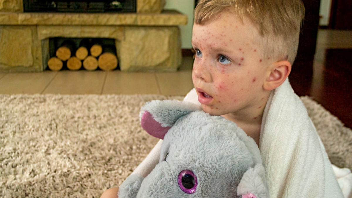 rujeola-face-ravagii-in-romania-13-000-de-cazuri-si-8-vieti-pierdute-intr-un-an--desi-exista-vaccin--rata-de-imunizare--cea-mai-scazuta-din-ue_19824800