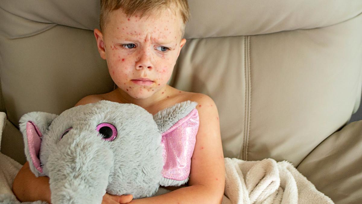 miturile-periculoase-despre-rujeola-si-vaccin--dr--mihai-craiu-cei-care-inca-mai-cred-ca-este-mai-bine-sa-faca-boala-as-vrea-sa-ii-rog-sa-mergem-impreuna-la-cimitirul-din-slanic-prahova_16090500