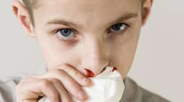 Sângerări nazale la copii, ce trebuie făcut în caz de epistaxis