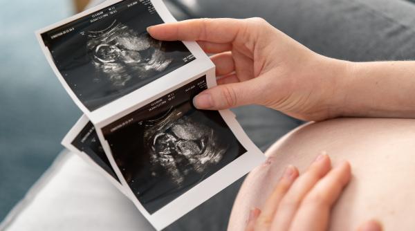 Sindromul geamănului care dispare: Ce este, de ce apare și care sunt consecințele lui? 