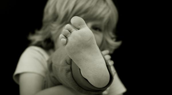 Valgus: Picioare în formă de X la copii. Află care sunt principalele cauze și cum să rezolvi afecțiunea