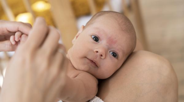 Acnee și alte coșuri la bebeluși: Cum să le distingem și cum procedăm dacă apar?