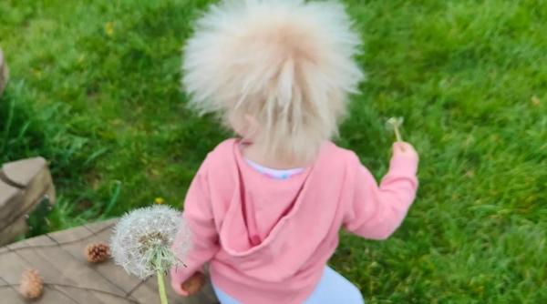 Această fetiță adorabilă este una dintre cei 100 de oameni din lume cu o mutație genetică rară: „Noi nu o tratăm altfel, dar restul lumii o face” / FOTO