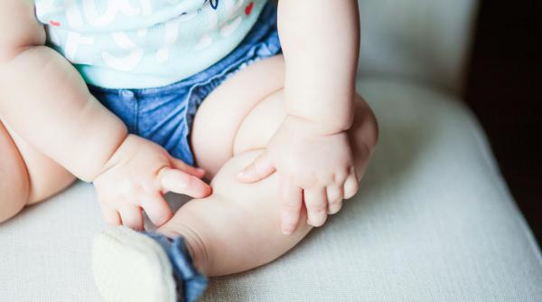 Alunițe la copii: Când este cazul să mergi la dermatolog