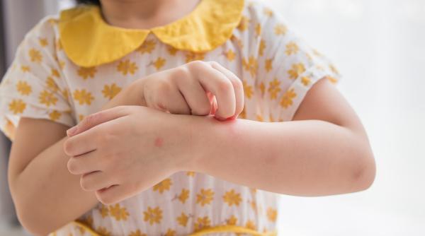 Feriți-vă de mușcăturile de vară. Cum să vă asigurați că nu sunteți infectat cu boala Lyme