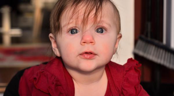 Ce este boala obrajilor pălmuiți și cum o recunoști?