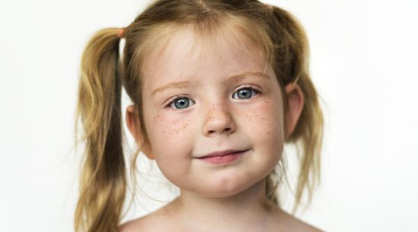 Ce este impetigo și cum se transmite?