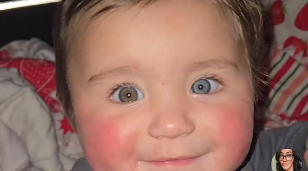  „Un bebeluș cu adevărat unic”: ochi, păr și piele în culori diferite după o sarcină cu risc ridicat